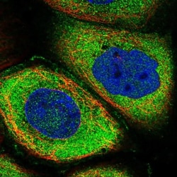 Roquin Antibody, Novus Biologicals:Antibodies:Primary Antibodies